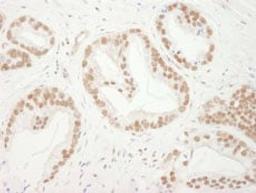 Detection of human Bub3 by immunohistochemistry.