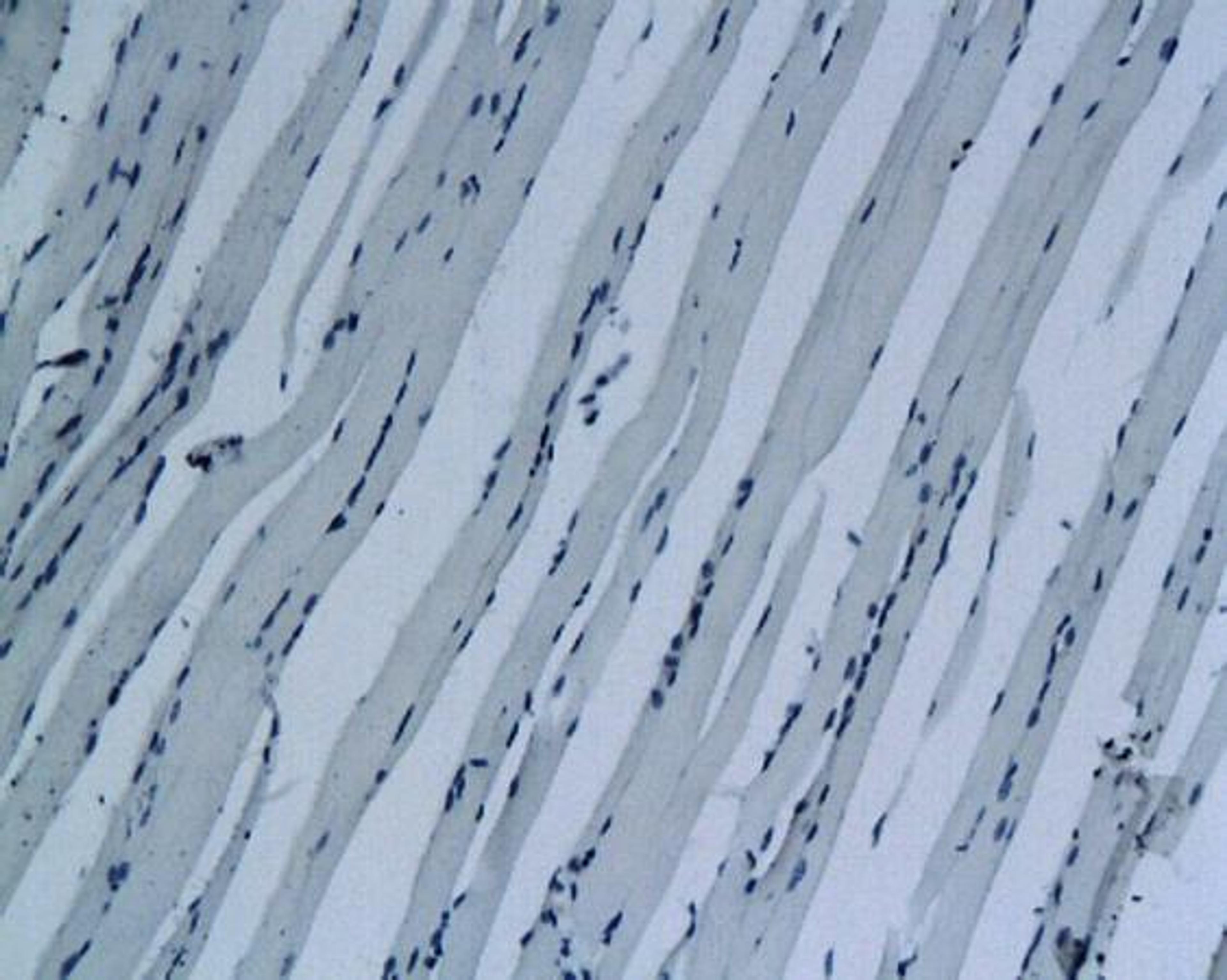 Immunohistochemical analysis of paraffin-embedded mouse skeletal muscle tissue using MyoD1 antibody