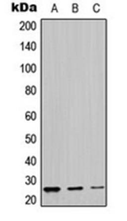 Western blot analysis of MDAMB453 (Lane 1), mouse kidney (Lane 2), rat kidney (Lane 3) whole cell lysates using LYPLA1 antibody