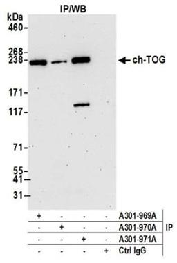 Detection of human ch-TOG by western blot of immunoprecipitates.