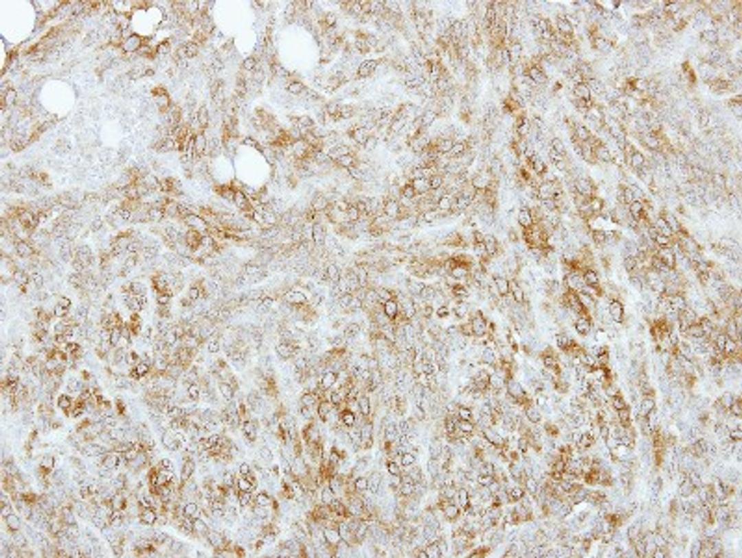 Immunohistochemistry-Paraffin: tropomyosin-4 Antibody [NBP2-15146] - Paraffin-embedded 4T1 xenograft, using antibody at 1:100 dilution.