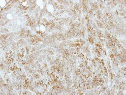 Immunohistochemistry-Paraffin: tropomyosin-4 Antibody [NBP2-15146] - Paraffin-embedded 4T1 xenograft, using antibody at 1:100 dilution.