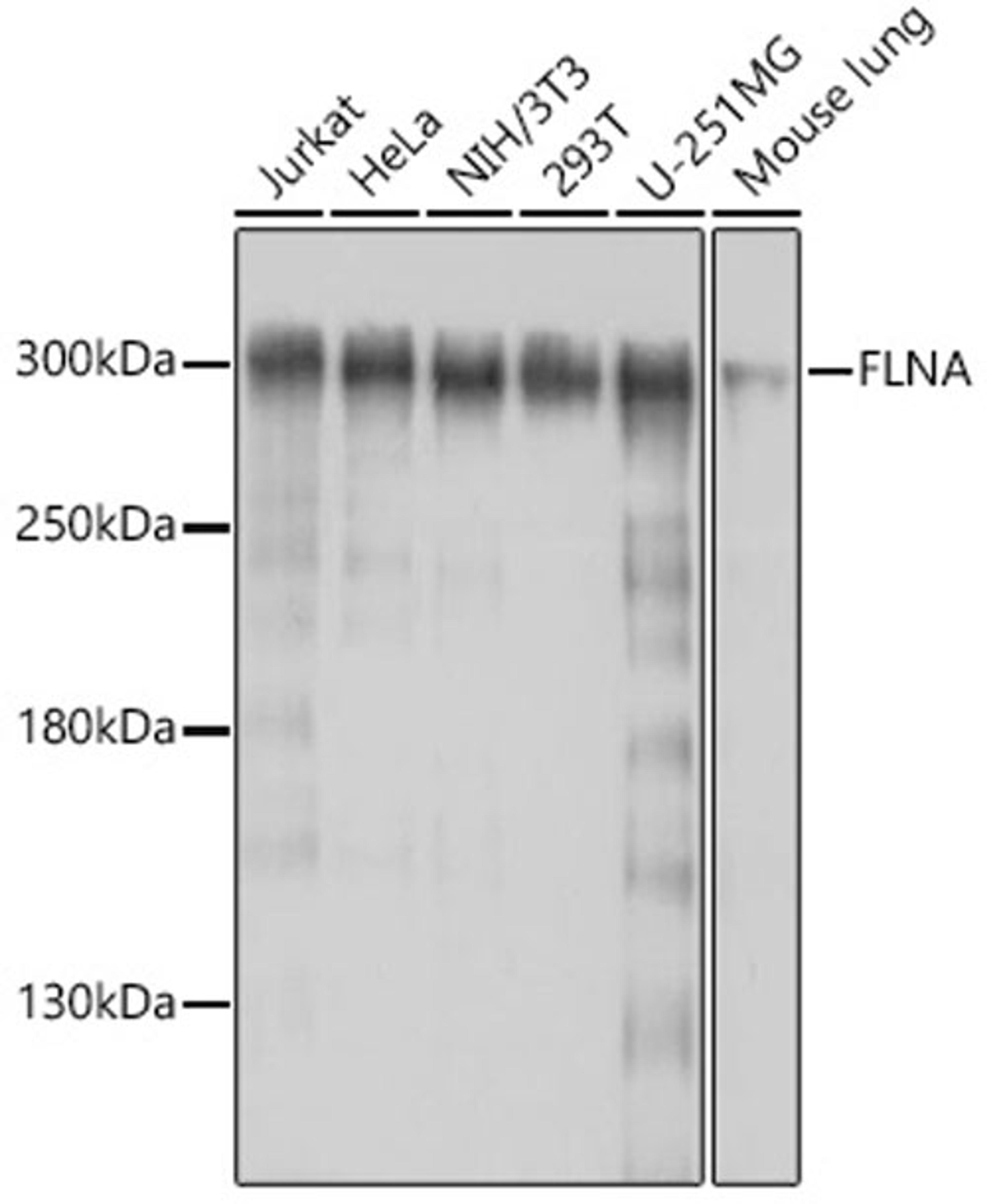 Western blot - FLNA antibody (A16376)