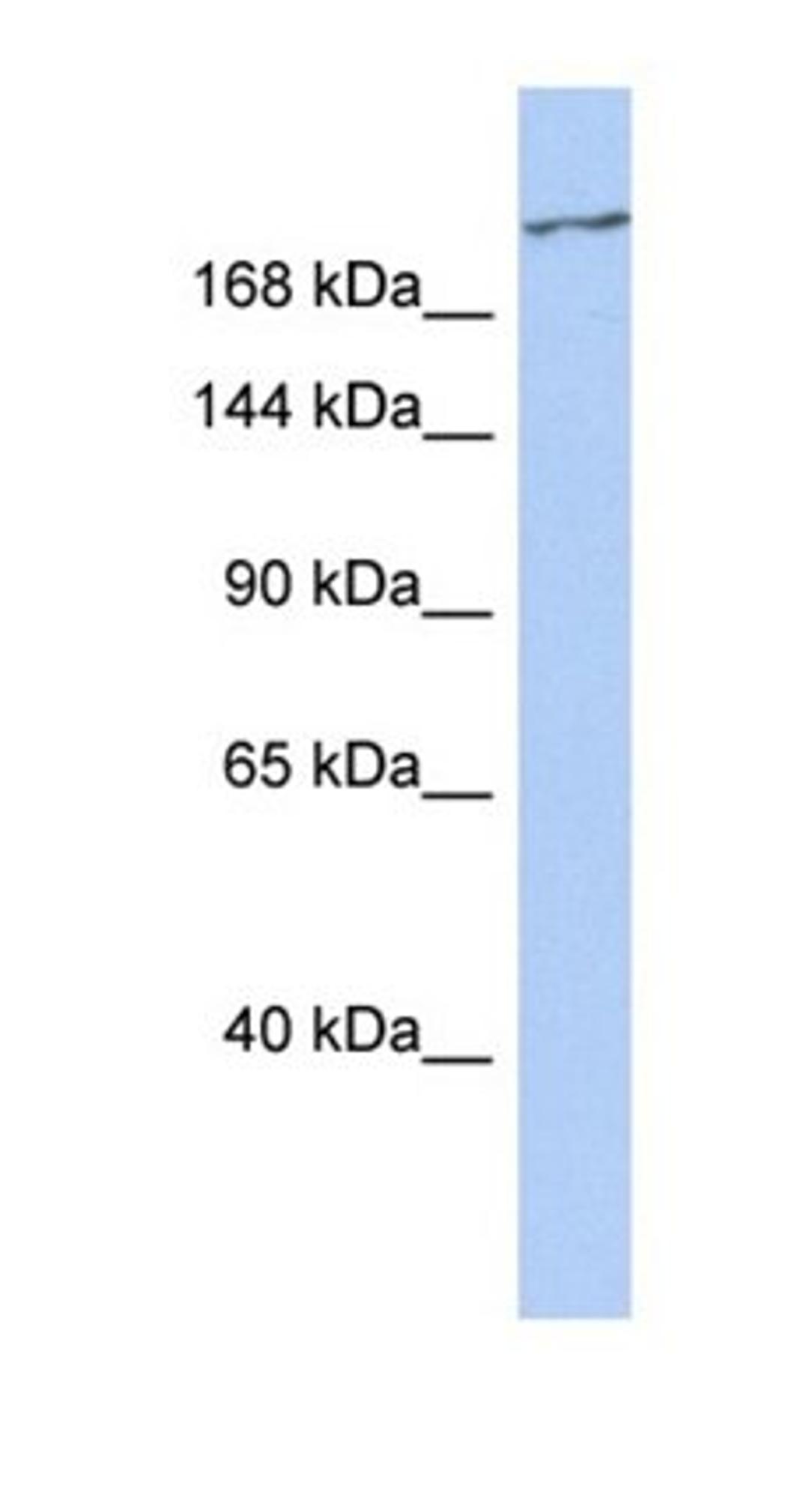 Western blot analysis of human Spleen tissue using CACNA1G antibody