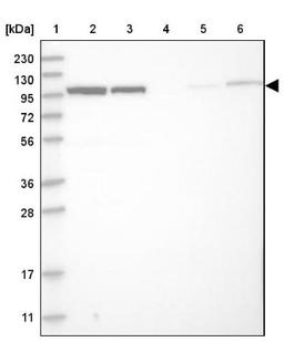 Western Blot: BICD2 Antibody [NBP1-81488] - Lane 1: Marker [kDa] 230, 130, 95, 72, 56, 36, 28, 17, 11<br/>Lane 2: Human cell line RT-4<br/>Lane 3: Human cell line U-251MG sp<br/>Lane 4: Human plasma (IgG/HSA depleted)<br/>Lane 5: Human liver tissue<br/>Lane 6: Human tonsil tissue