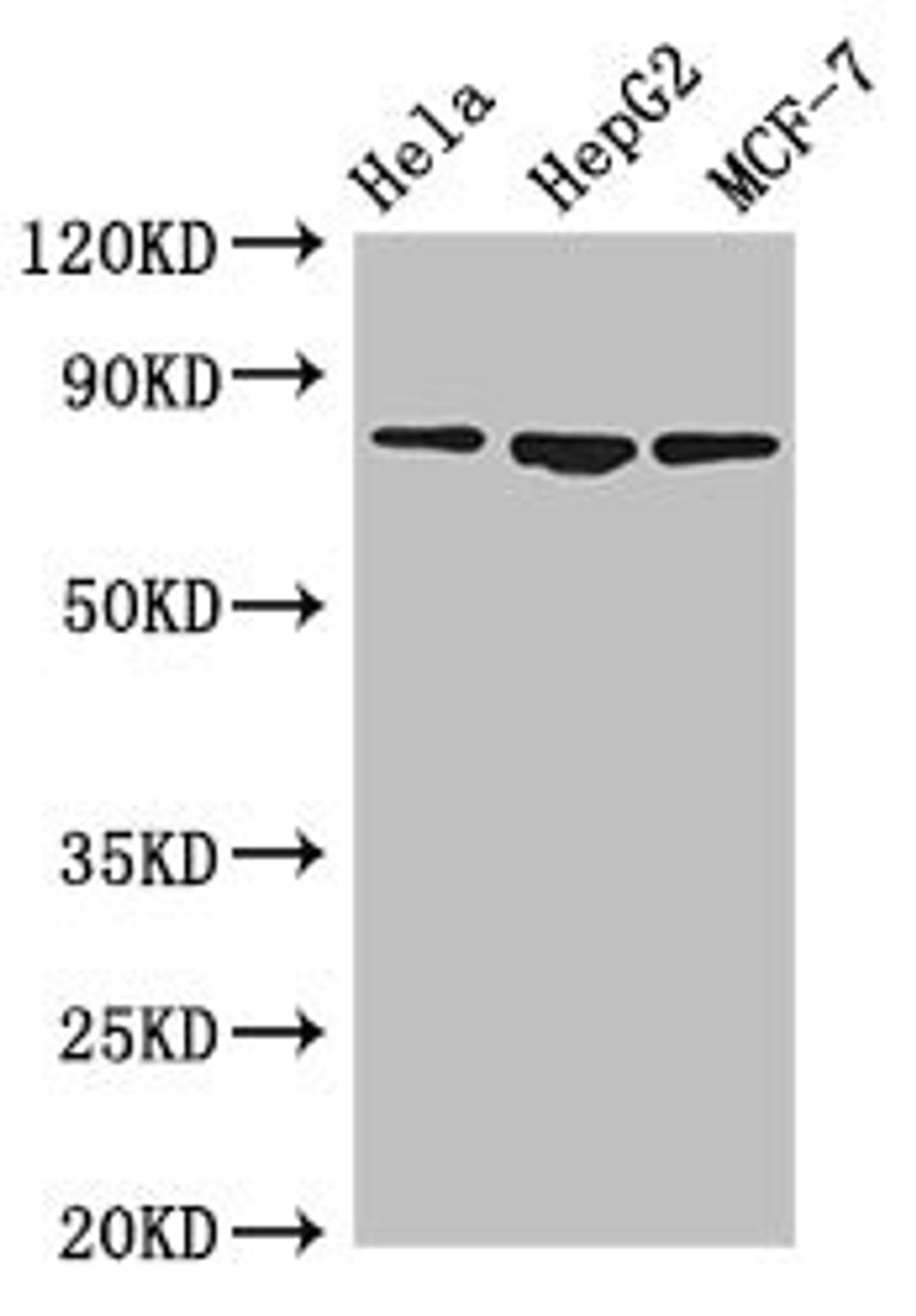 Western Blot. Positive WB detected in: Hela whole cell lysate, HepG2 whole cell lysate, MCF-7 whole cell lysate. All lanes: IMMT antibody at 3.5ug/ml. Secondary. Goat polyclonal to rabbit IgG at 1/50000 dilution. Predicted band size: 84, 83, 81 kDa. Observed band size: 84 kDa.