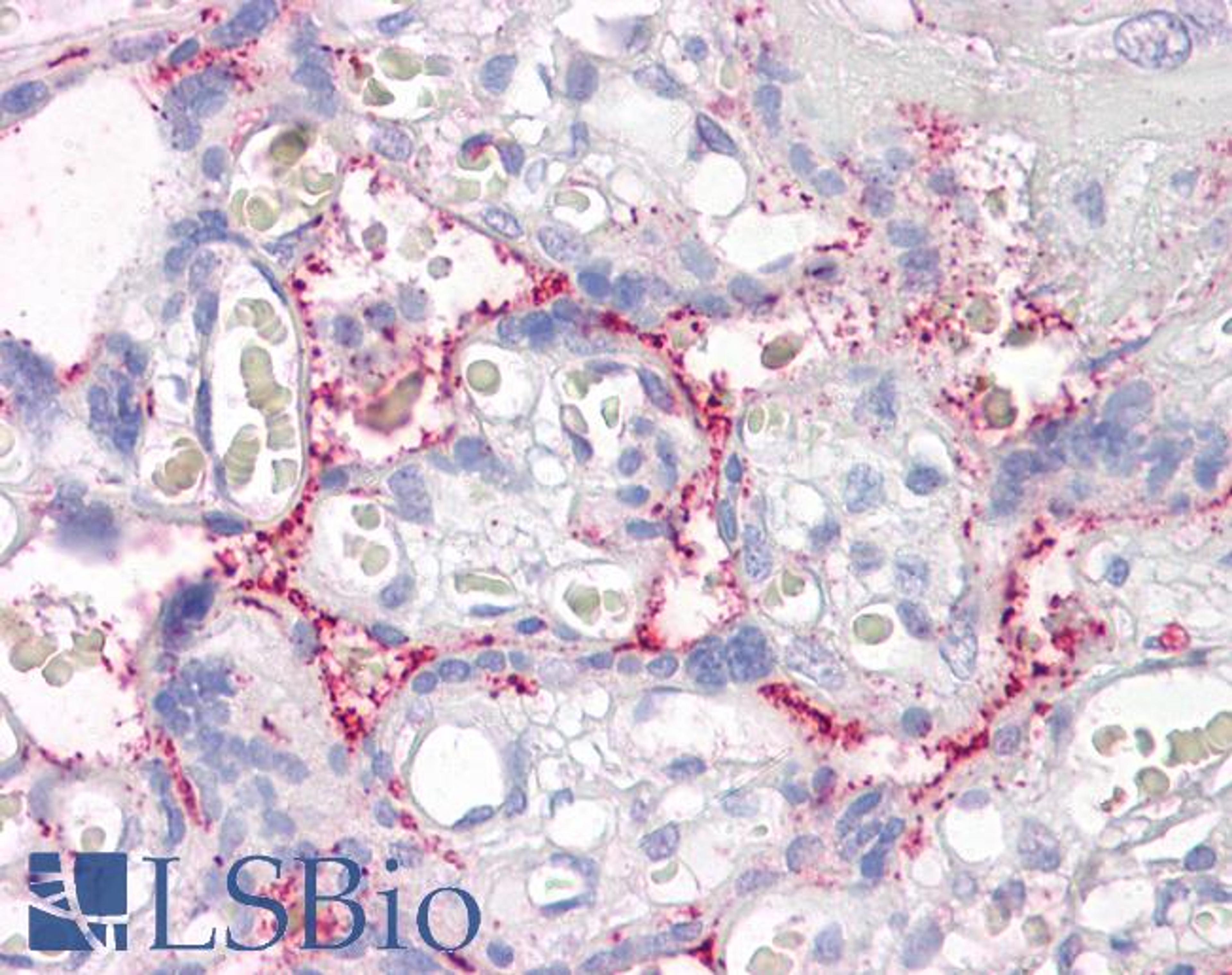 46-272 (3.75ug/ml) staining of paraffin embedded Human Placenta. Steamed antigen retrieval with citrate buffer pH 6, AP-staining.