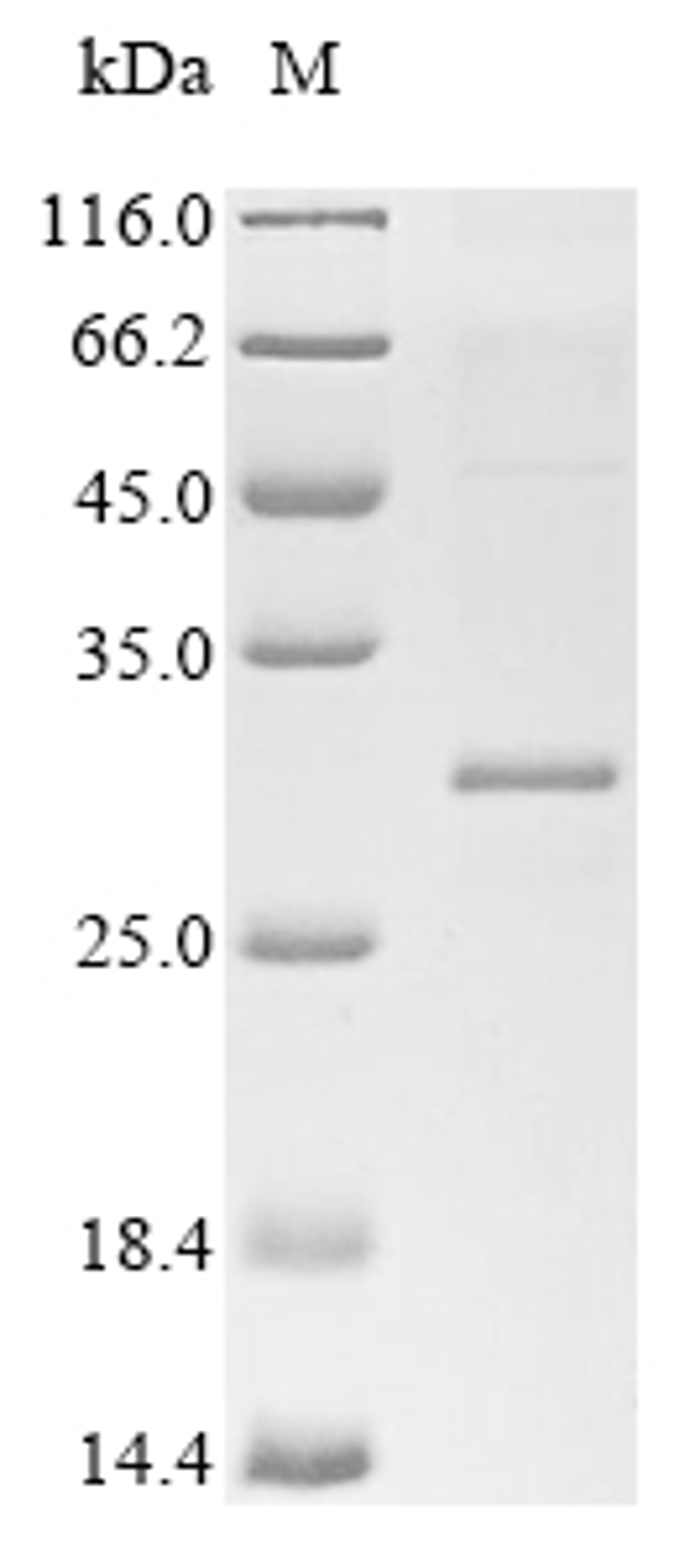 (Tris-Glycine gel) Discontinuous SDS-PAGE (reduced) with 5% enrichment gel and 15% separation gel.