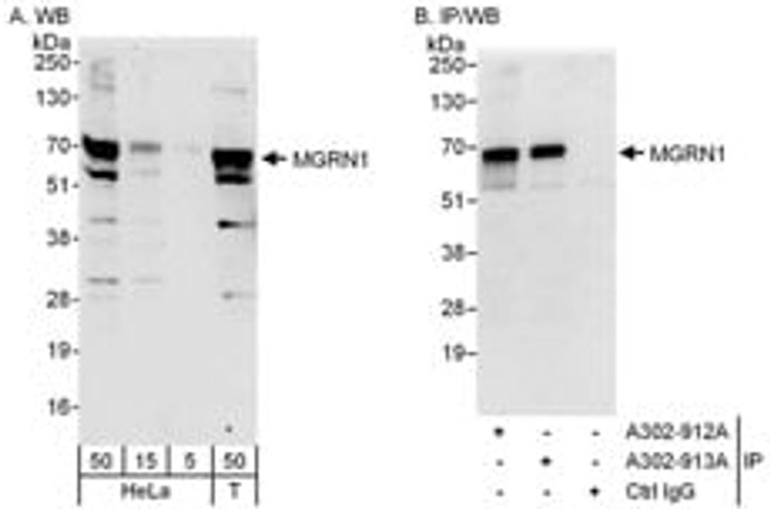 Detection of human MGRN1 by western blot and immunoprecipitation.