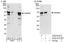 Detection of human MGRN1 by western blot and immunoprecipitation.