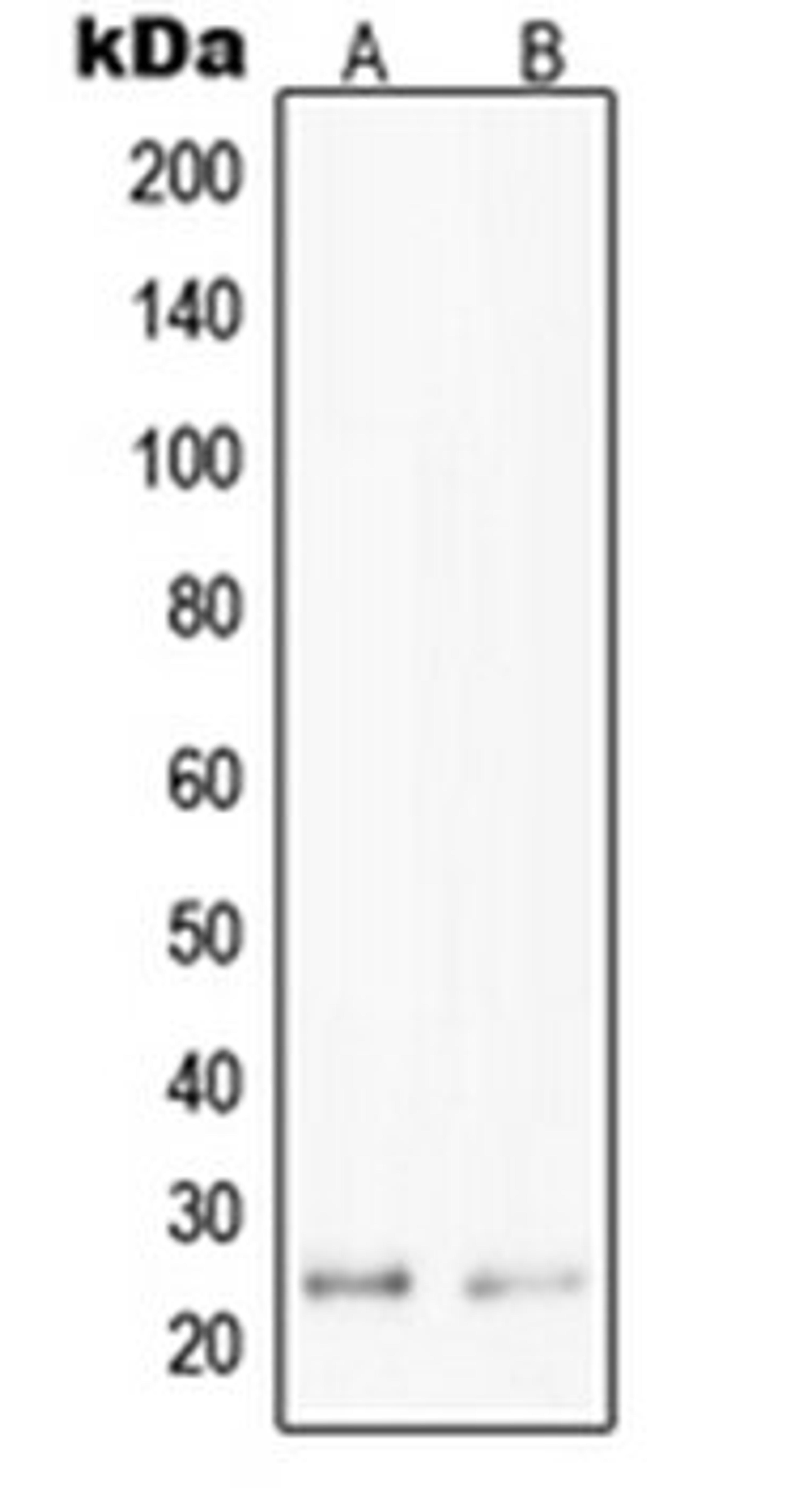 Western blot analysis of Jurkat (Lane 1), HepG2 (Lane 2) whole cell lysates using PPP1R14D antibody