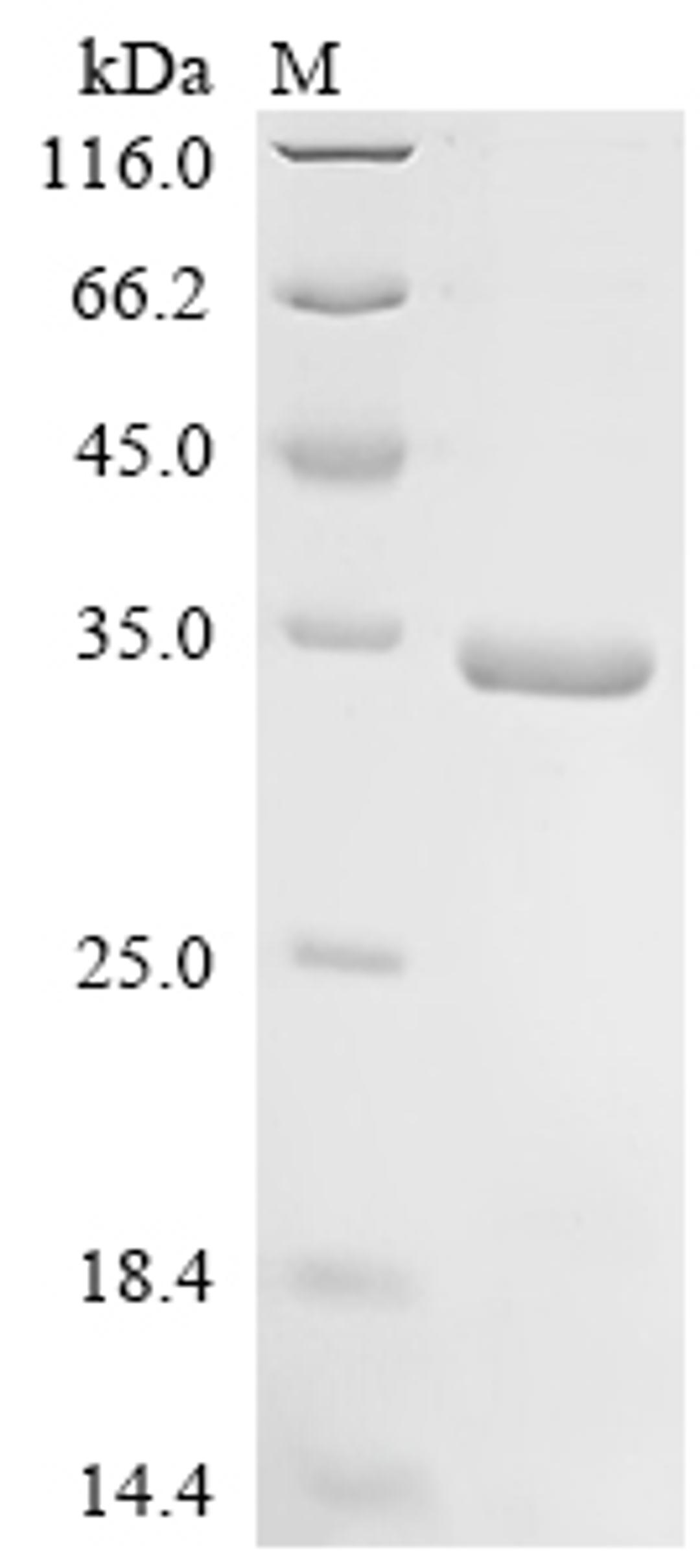 (Tris-Glycine gel) Discontinuous SDS-PAGE (reduced) with 5% enrichment gel and 15% separation gel.