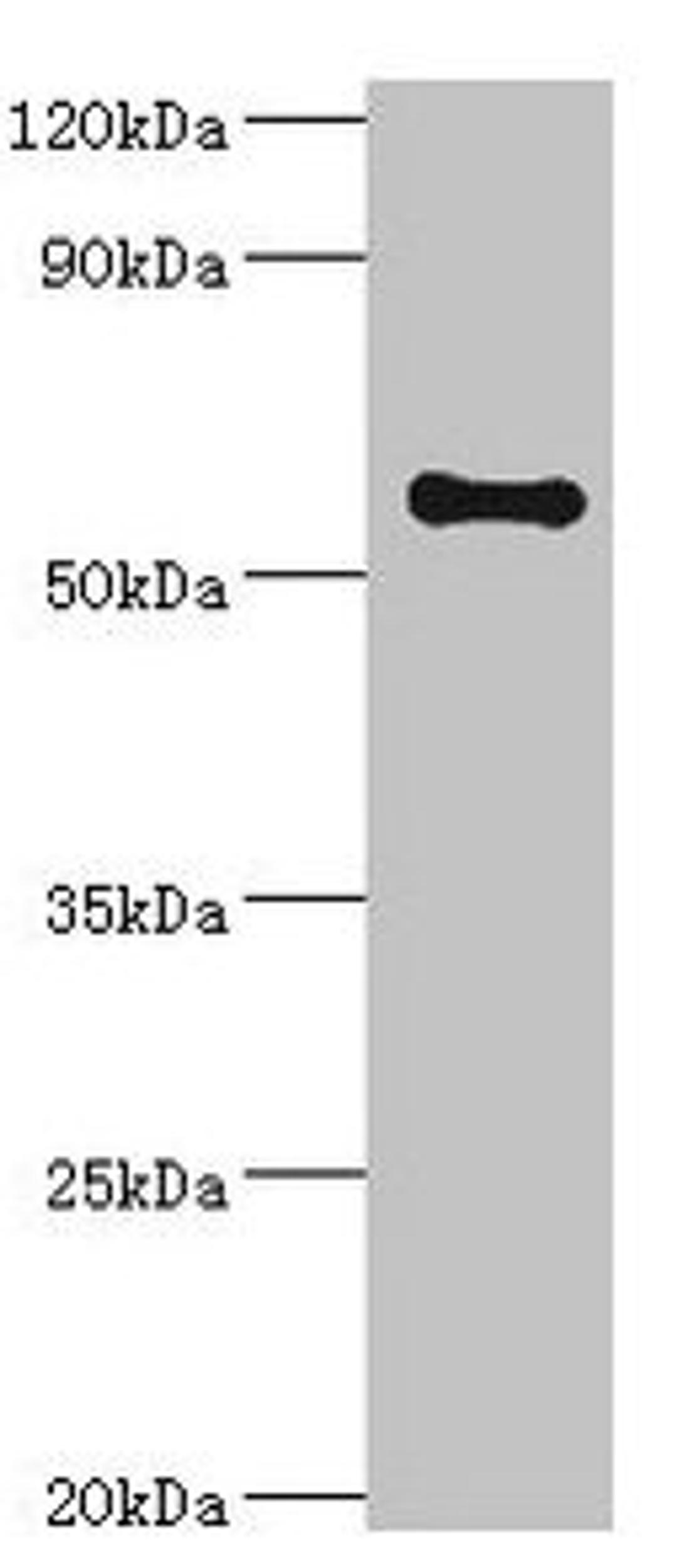 Western blot. All lanes: SCP2 antibody at 6µg/ml + A2780 whole cell lysate. Secondary. Goat polyclonal to rabbit IgG at 1/10000 dilution. Predicted band size: 59, 16, 35, 51, 7, 55, 57 kDa. Observed band size: 59 kDa