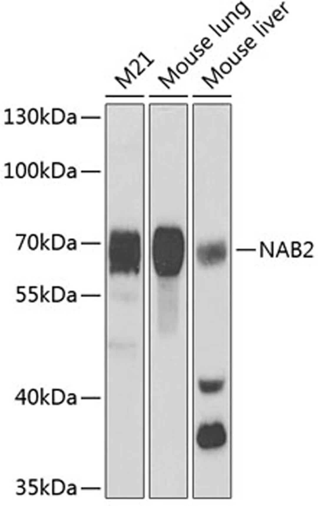 Western blot - NAB2 antibody (A5827)