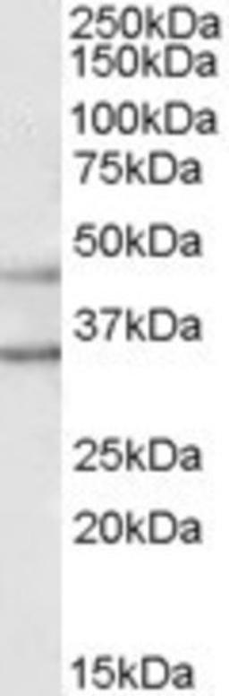 Western Blot: GIRK2 Antibody [NB100-74575] - (1ug/ml) staining of Human Brain (Substantia Nigra) lysate (35ug protein in RIPA buffer). Primary incubation was 1 hour. Detected by chemiluminescence.