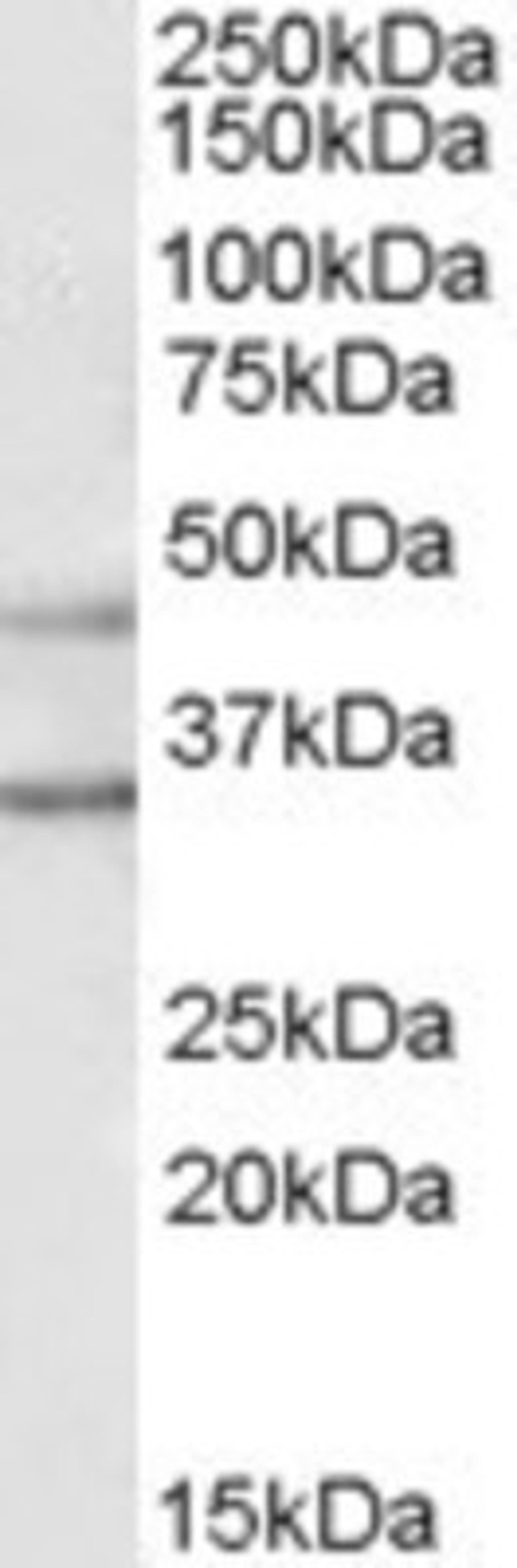 Western Blot: GIRK2 Antibody [NB100-74575] - (1ug/ml) staining of Human Brain (Substantia Nigra) lysate (35ug protein in RIPA buffer). Primary incubation was 1 hour. Detected by chemiluminescence.