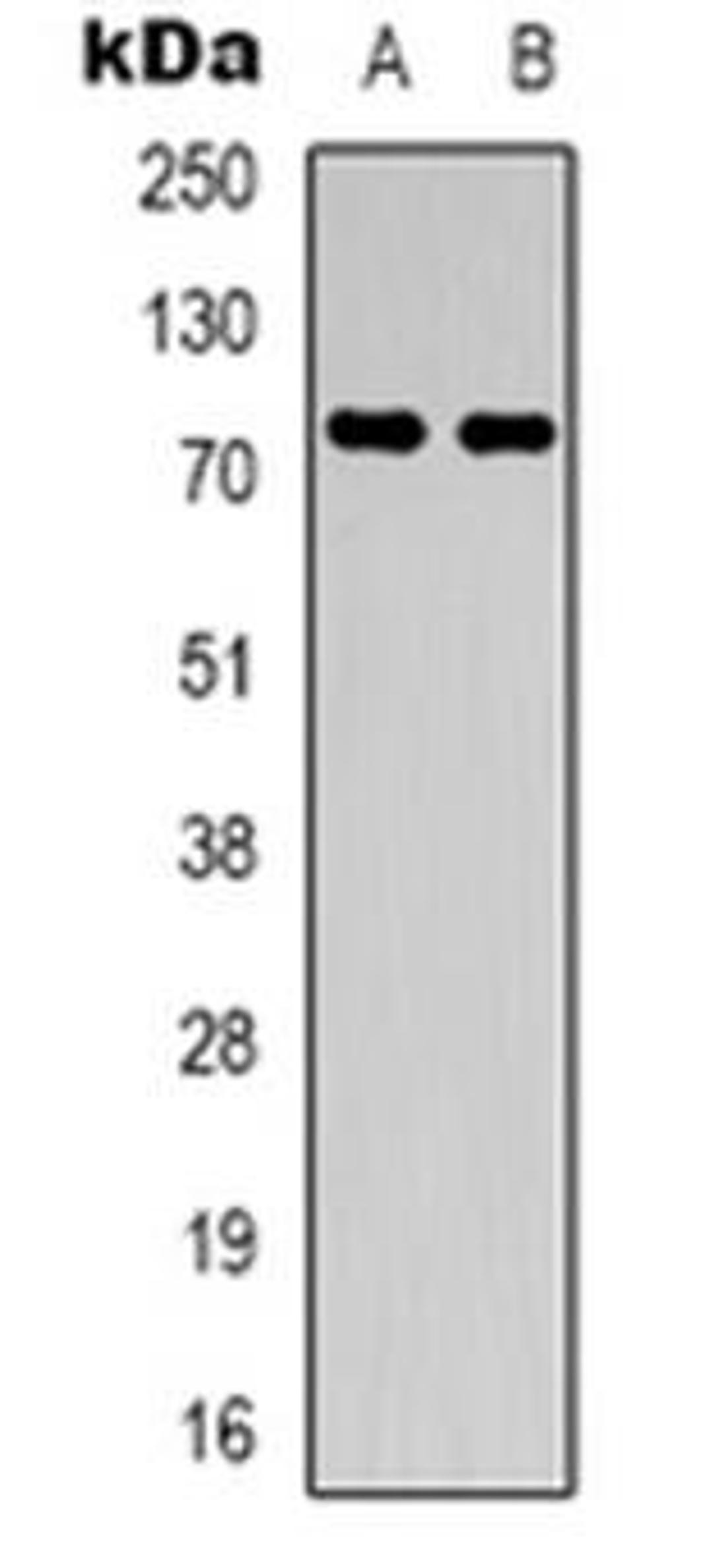 Western blot analysis of PRPF39 expression in Hela (Lane 1), K562 (Lane 2) whole cell lysates using PRPF39 antibody