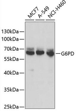 Western blot - G6PD antibody (A13983)