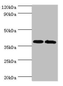Western blot. All lanes: PBK antibody at 6ug/ml. Lane 1: Hela whole cell lysate. Lane 2: Mouse gonad tissue. Secondary. Goat polyclonal to rabbit IgG at 1/10000 dilution. Predicted band size: 37, 38 kDa. Observed band size: 37 kDa. 