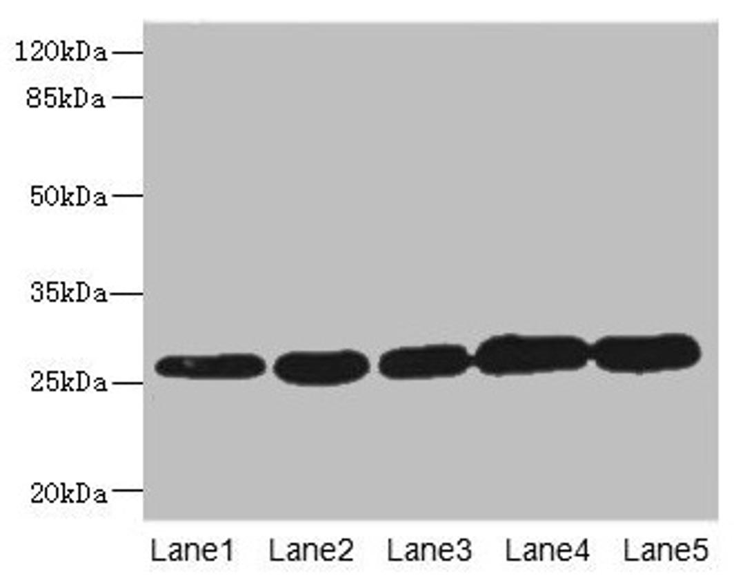 Western blot. All lanes: GSTK1 antibody at 0.51µg/ml. Lane 1: MCF-7 whole cell lysate. Lane 2: K562 whole cell lysate. Lane 3: Hela whole cell lysate. Lane 4: HepG2 whole cell lysate. Lane 5: Raji whole cell lysate. Secondary. Goat polyclonal to rabbit IgG at 1/10000 dilution. Predicted band size: 26, 32, 25, 21 kDa. Observed band size: 26 kDa