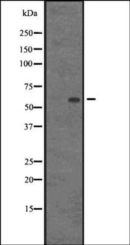 Western blot analysis of AGFG1 transfected 293T cells using HRB antibody