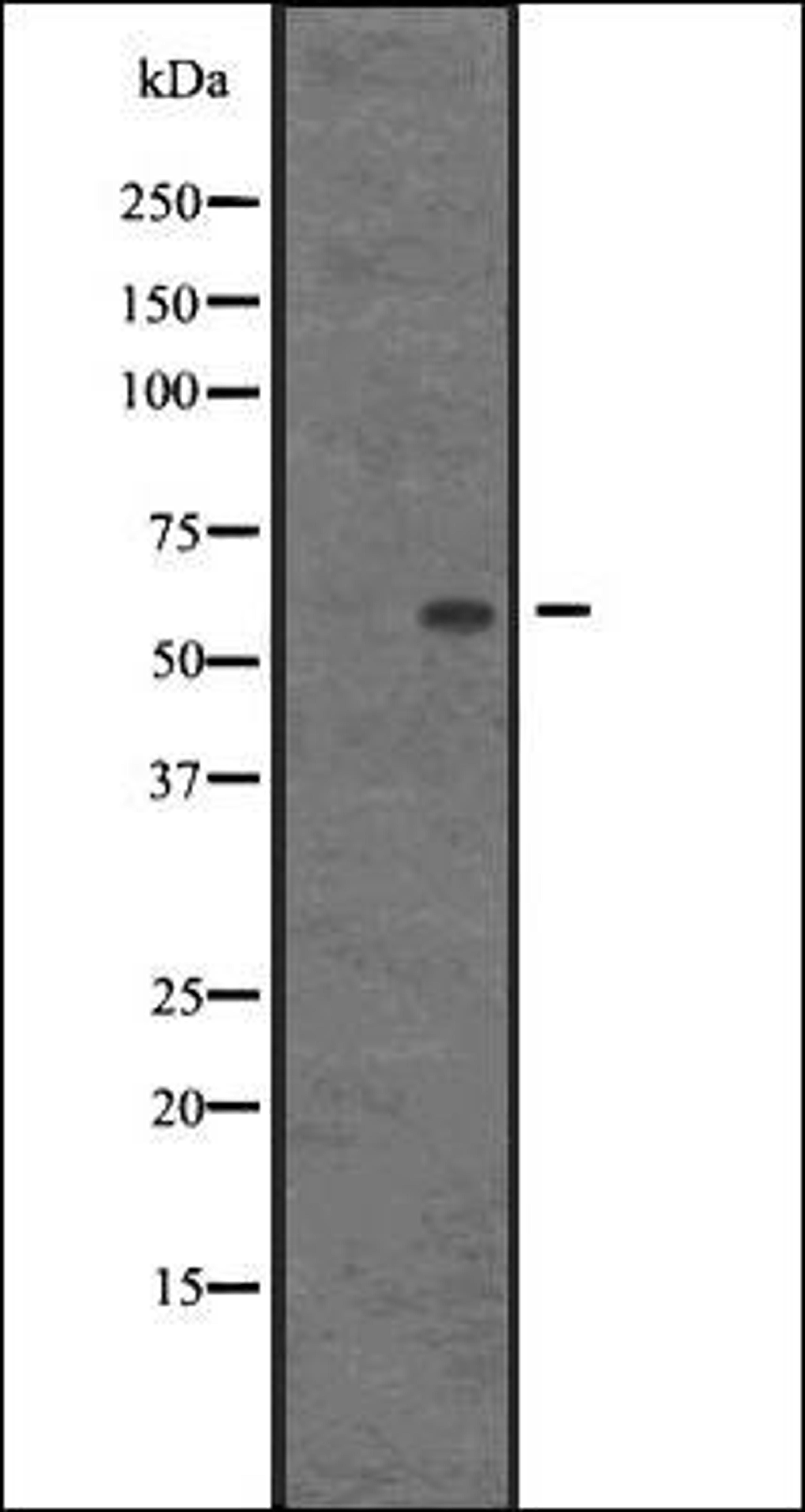 Western blot analysis of AGFG1 transfected 293T cells using HRB antibody