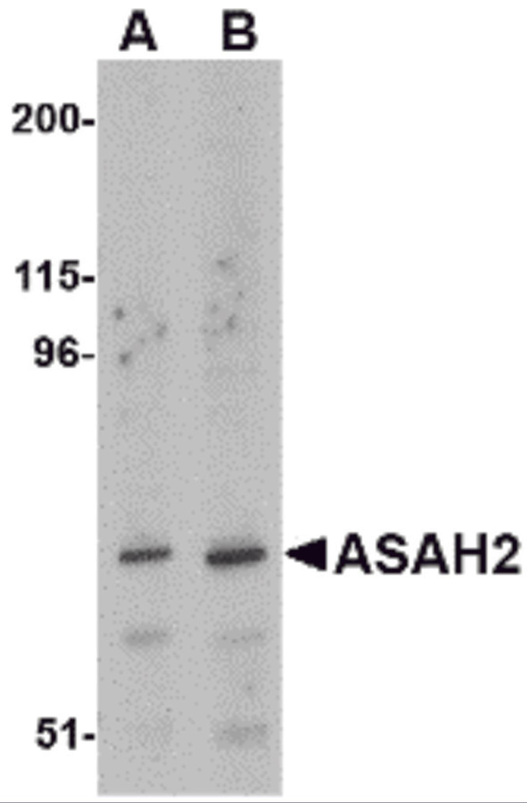Western blot analysis of ASAH2 in 293 cell lysate with ASAH2 antibody at (A) 1 and (B) 2 μg/mL.