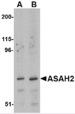 Western blot analysis of ASAH2 in 293 cell lysate with ASAH2 antibody at (A) 1 and (B) 2 μg/mL.