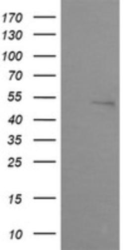 Western Blot: ZSCAN21/ZFP38 Antibody (2E5) [NBP2-45443] - Analysis of HEK293T cells were transfected with the pCMV6-ENTRY control (Left lane) or pCMV6-ENTRY ZSCAN21.