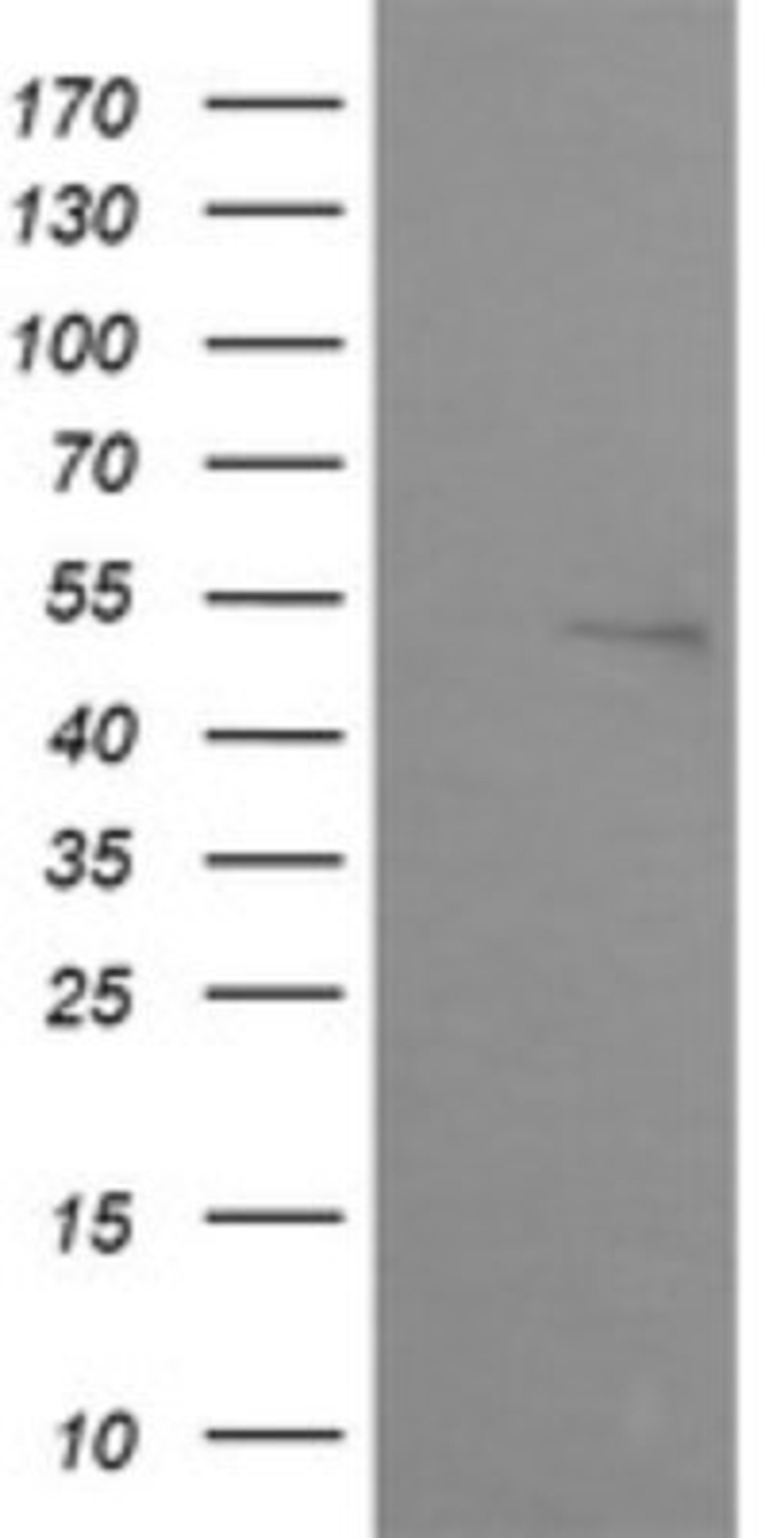 Western Blot: ZSCAN21/ZFP38 Antibody (2E5) [NBP2-45443] - Analysis of HEK293T cells were transfected with the pCMV6-ENTRY control (Left lane) or pCMV6-ENTRY ZSCAN21.