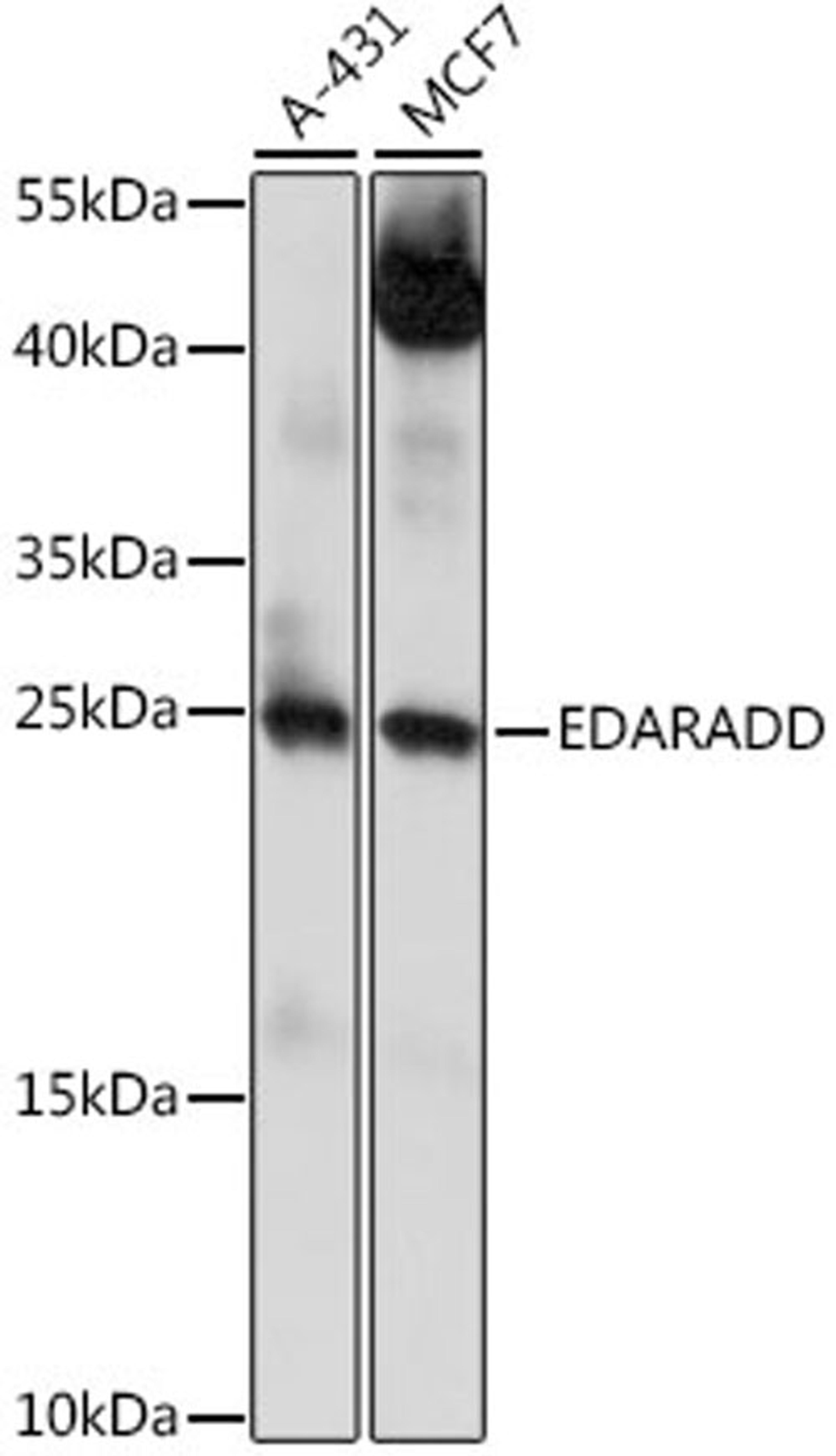 Western blot - EDARADD antibody (A15950)