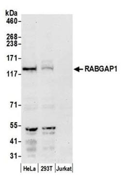 Detection of human RABGAP1 by western blot.