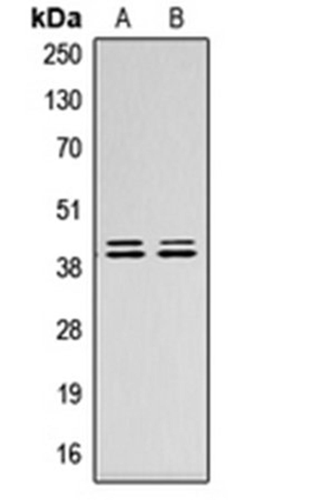 Western blot analysis of HepG2 (Lane 1), NIH3T3 (Lane 2) whole cell lysates using ERK1/2 antibody