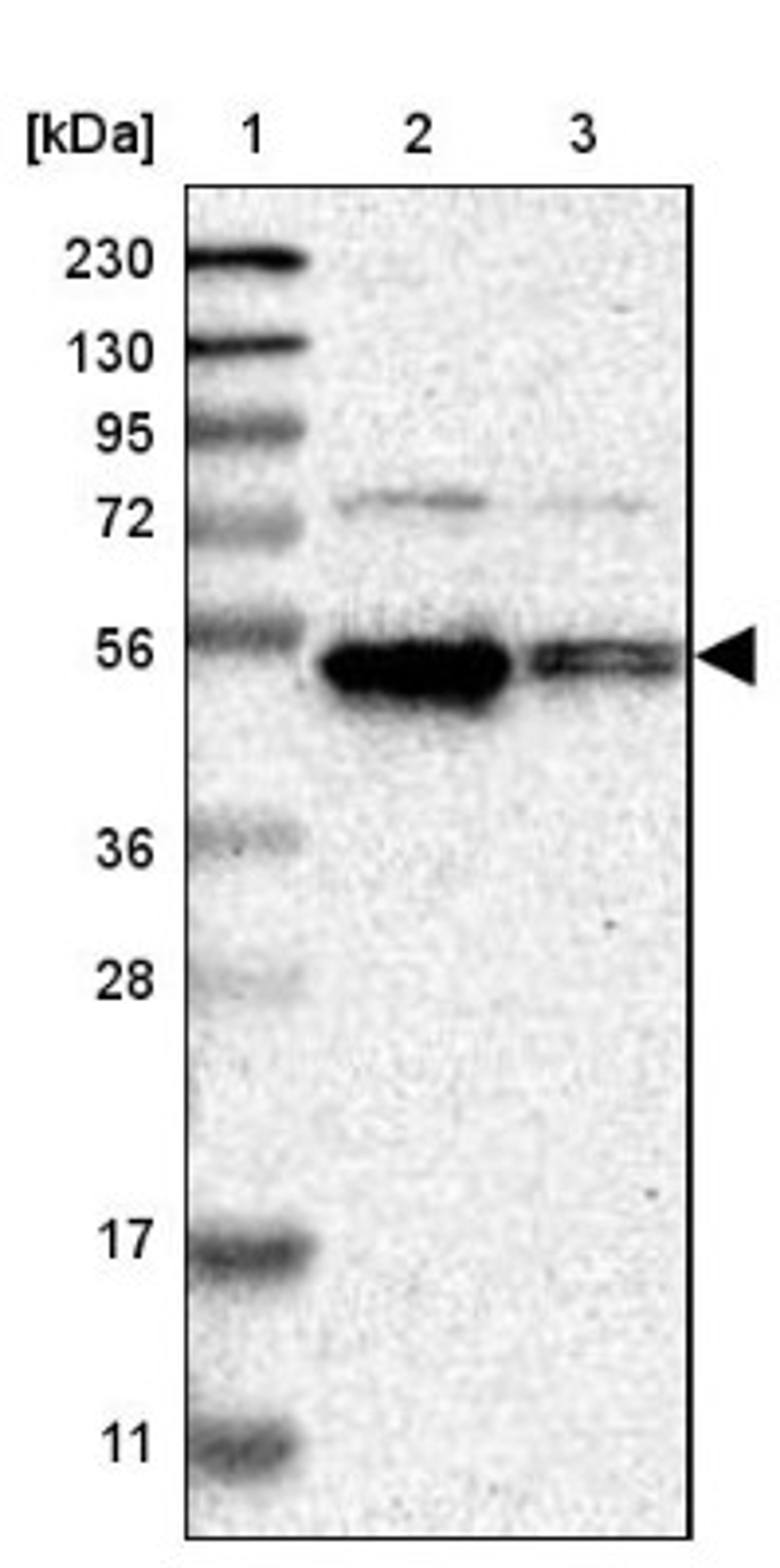 Western Blot: Cyclin E Antibody [NBP1-88153] - Lane 1: Marker [kDa] 230, 130, 95, 72, 56, 36, 28, 17, 11<br/>Lane 2: Human cell line RT-4<br/>Lane 3: Human cell line U-251MG sp