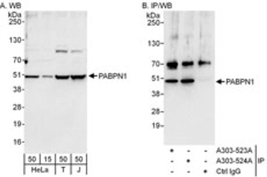 Detection of human PABPN1 by western blot and immunoprecipitation.