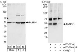 Detection of human PABPN1 by western blot and immunoprecipitation.