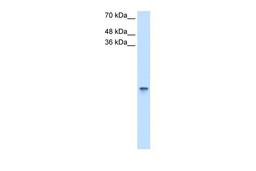 Antibody used in WB on Human HCT116 at 2.5 ug/ml.