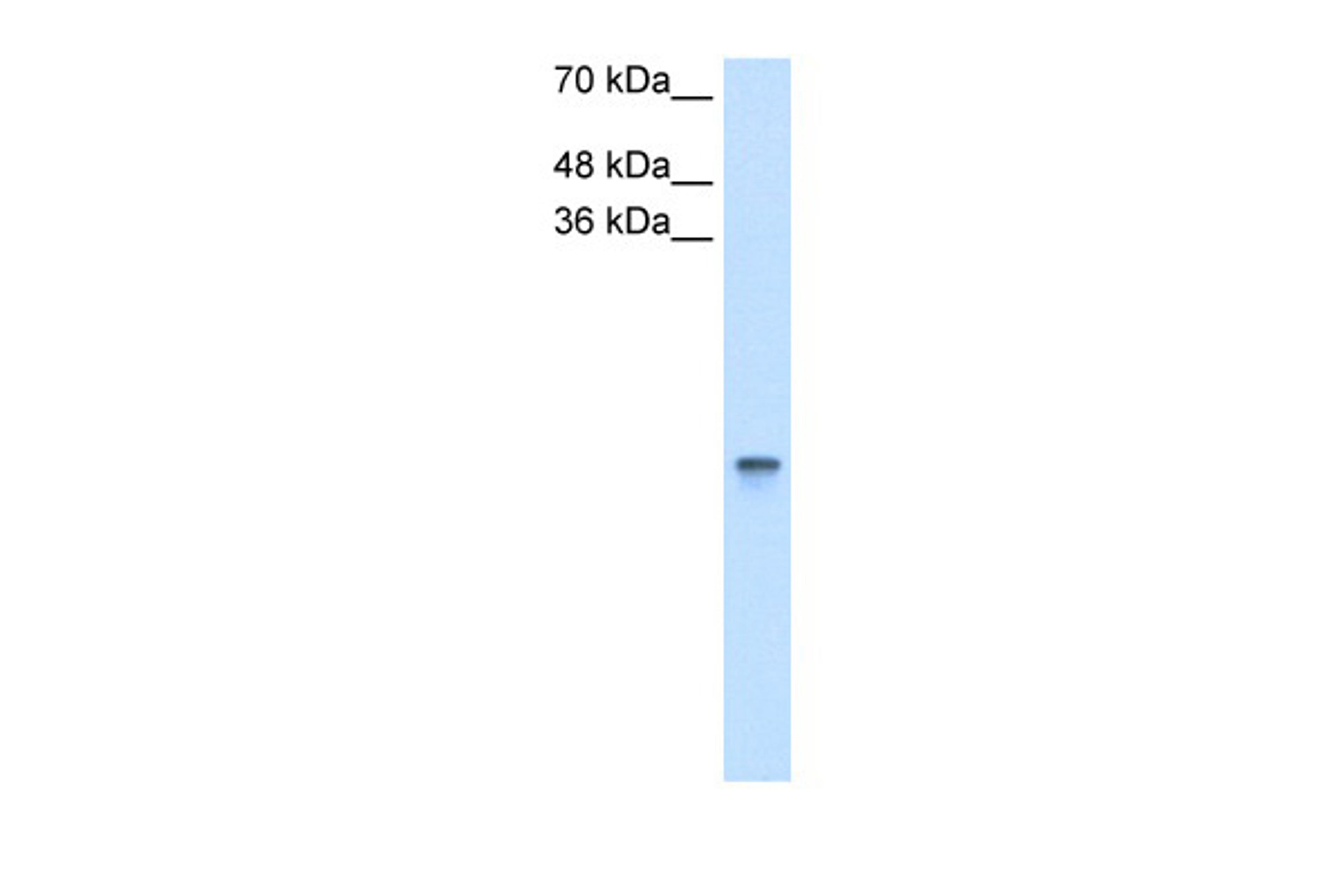 Antibody used in WB on Human HCT116 at 2.5 ug/ml.