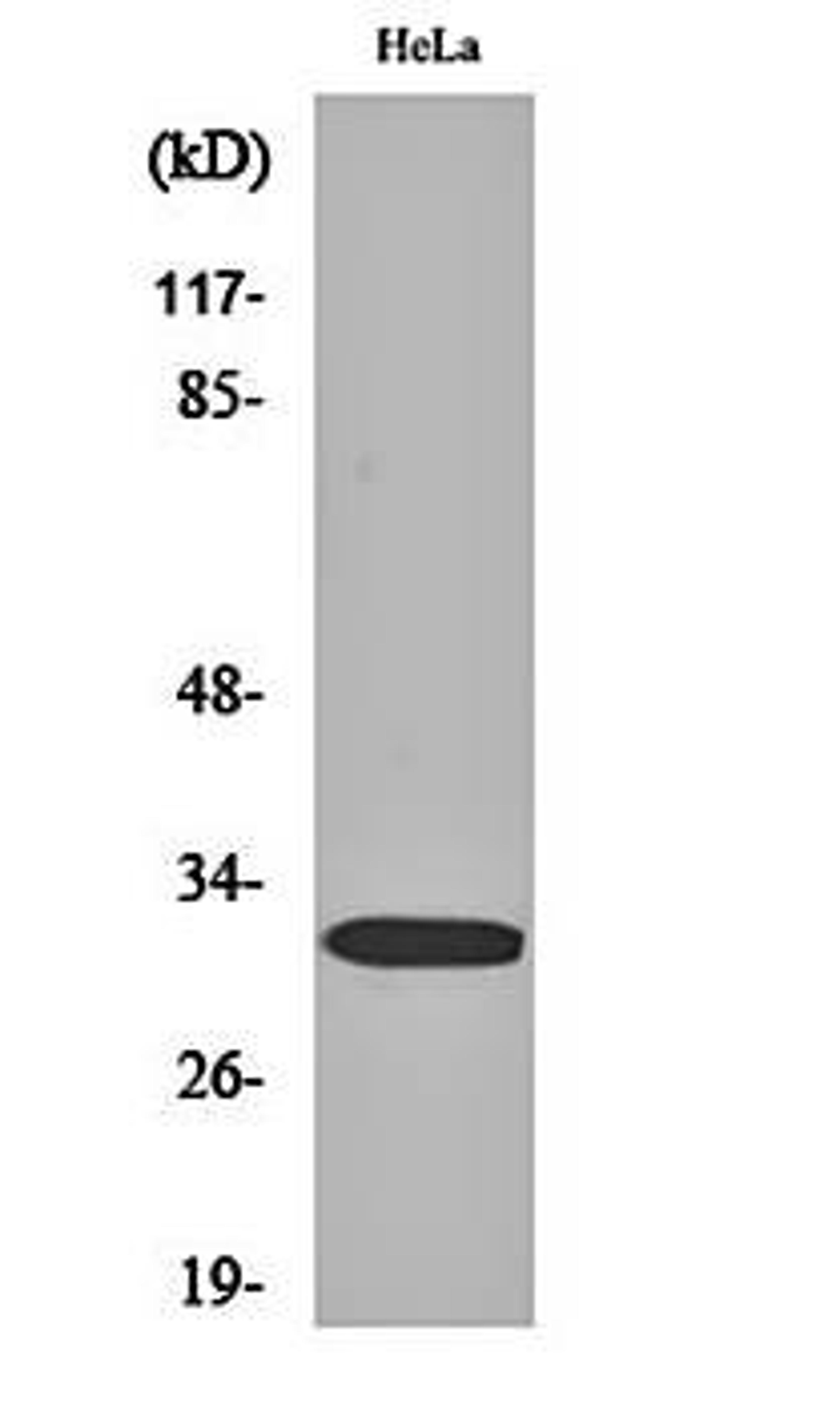 Western blot analysis of Hela cell lysates using DARPP-32 (phospho-T75) antibody