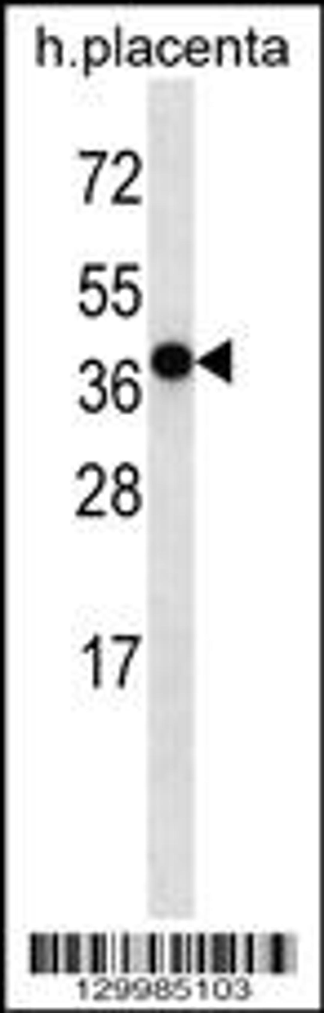 Western blot analysis in human placenta tissue lysates (35ug/lane).