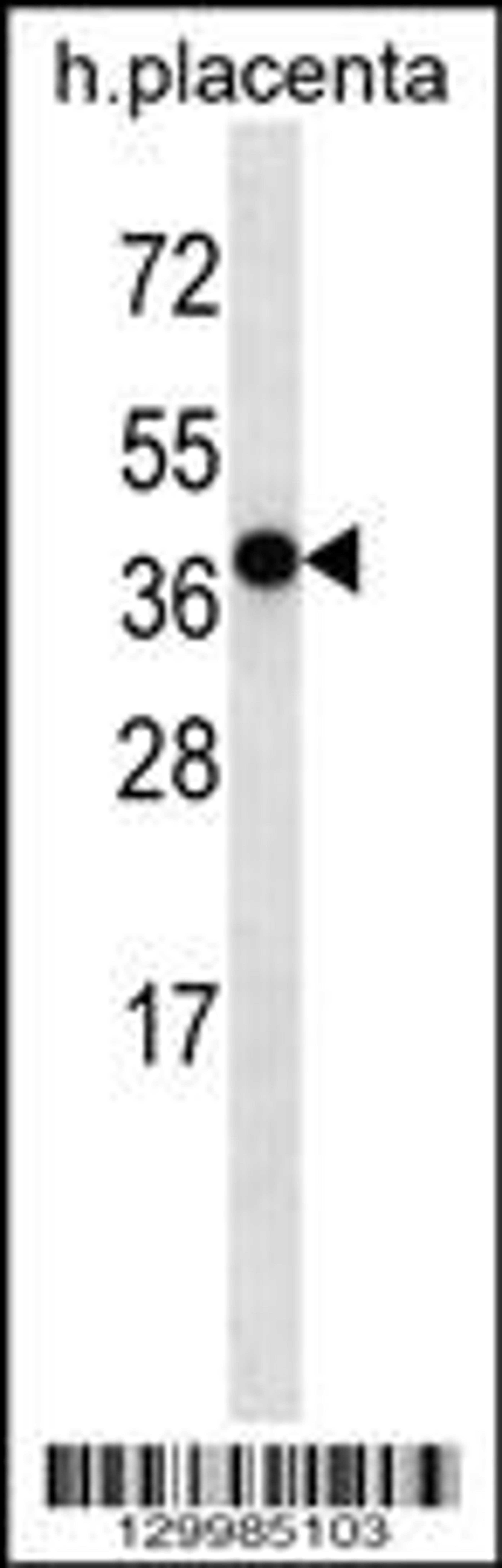 Western blot analysis in human placenta tissue lysates (35ug/lane).