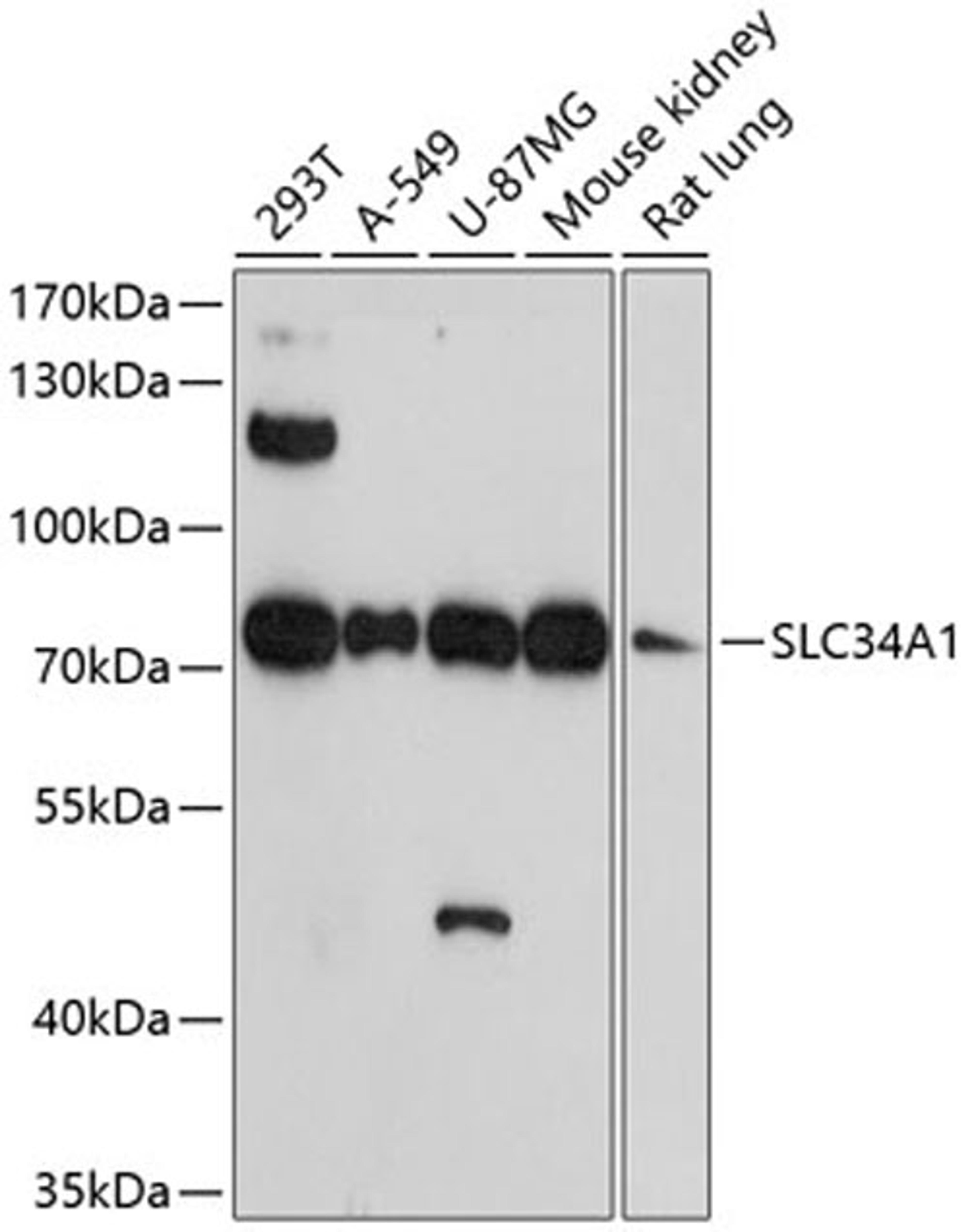 Western blot - SLC34A1 antibody (A13635)