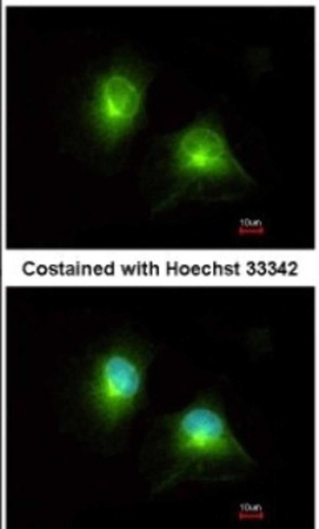 Immunocytochemistry/Immunofluorescence: HOOK2 Antibody [NBP2-14986] - Analysis of methanol-fixed HeLa, using antibody at 1:200 dilution.