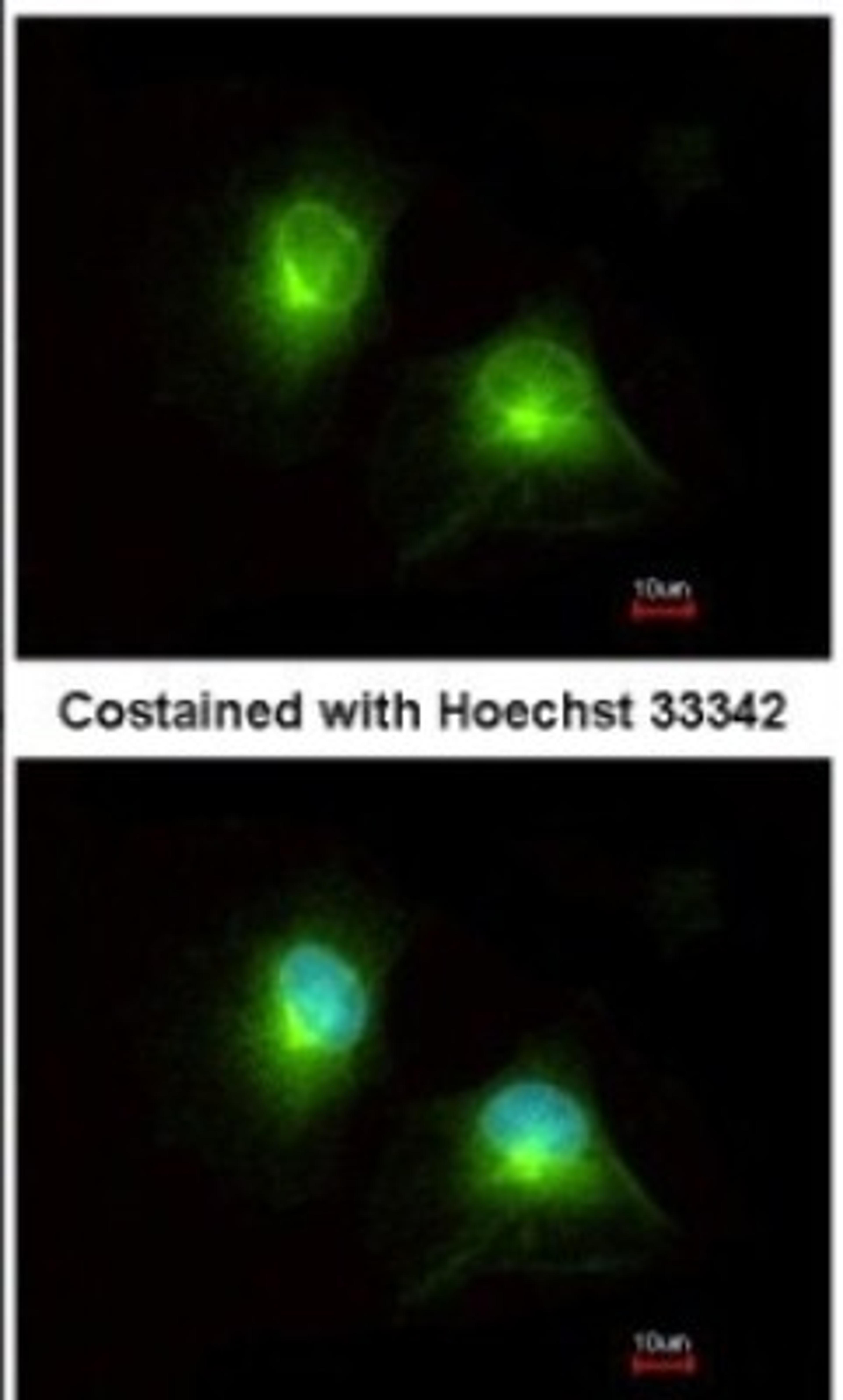 Immunocytochemistry/Immunofluorescence: HOOK2 Antibody [NBP2-14986] - Analysis of methanol-fixed HeLa, using antibody at 1:200 dilution.