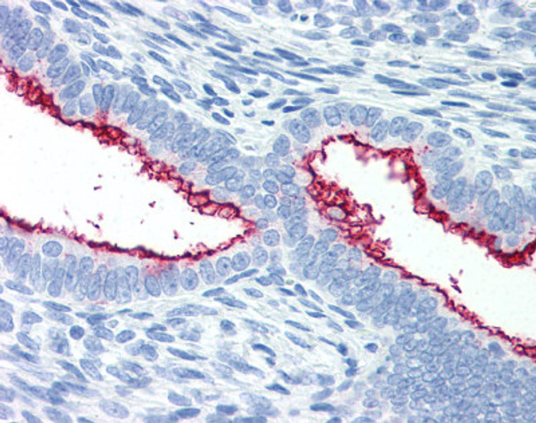 Immunohistochemistry staining of Mucin 16 in uterus tissue using Mucin 16 monoclonal Antibody.