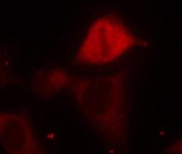 Immunocytochemistry/Immunofluorescence: MKK3/MEK3 [p Ser189] Antibody [NB100-82048] - Staining of methanol-fixed Hela cells using MEK3