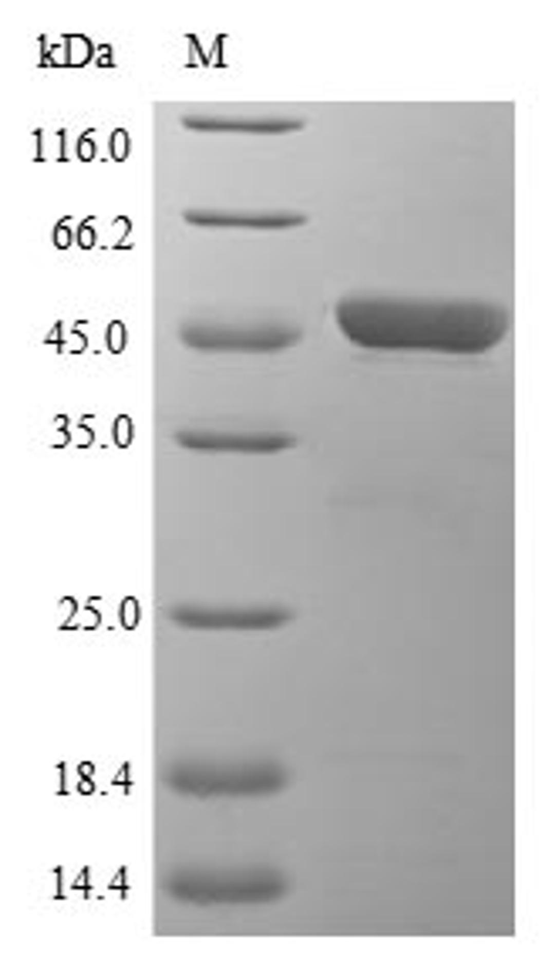 (Tris-Glycine gel) Discontinuous SDS-PAGE (reduced) with 5% enrichment gel and 15% separation gel.