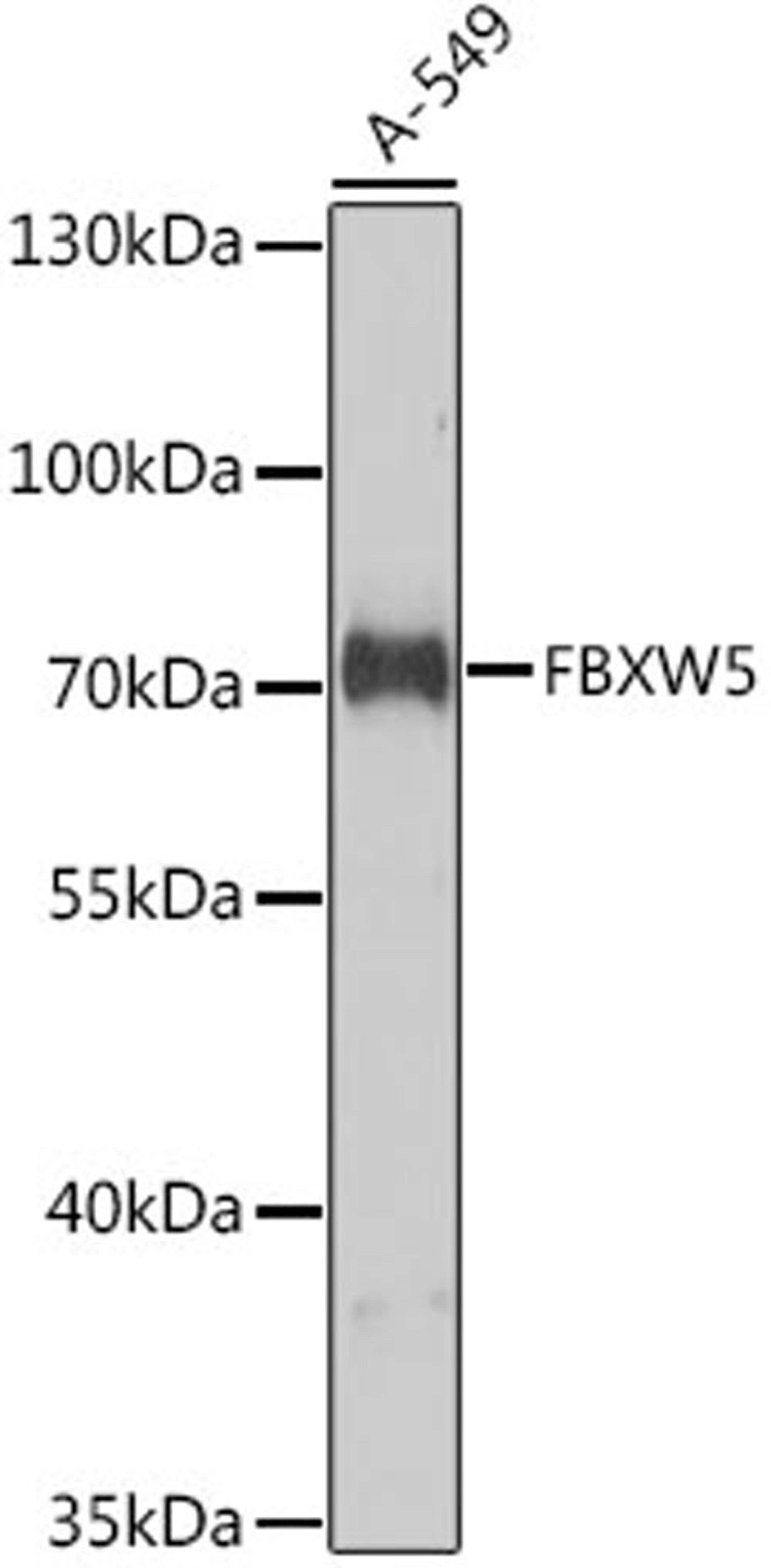 Western blot - FBXW5 antibody (A9345)