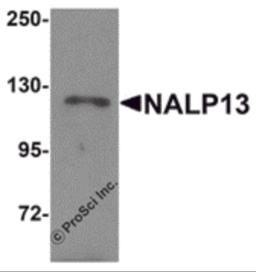 Western blot analysis of NALP13 in K562 cell lysate with NALP13 antibody at 1 &#956;g/mL.