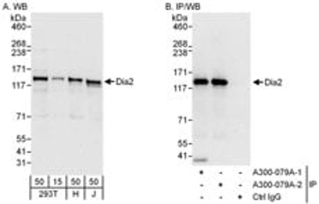 Detection of human Diaphanous 2 by western blot and immunoprecipitation.